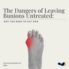 The Dangers of Leaving Bunions Untreated: Why You Need to Act Now